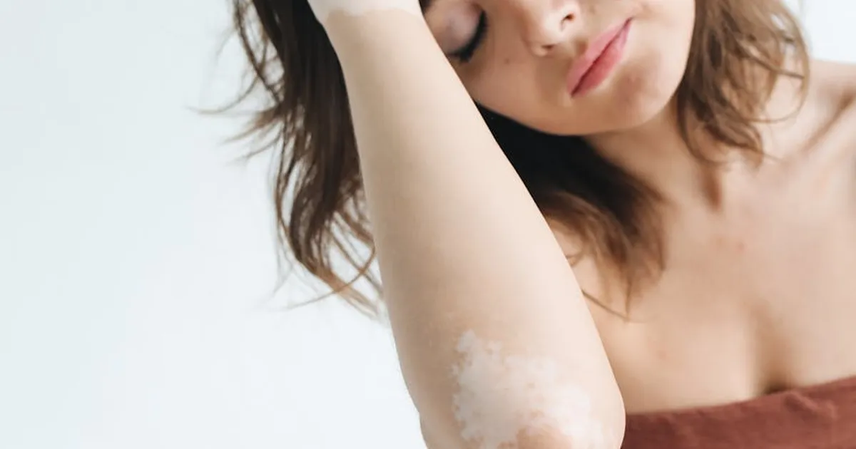 Understanding Sensitive Skin